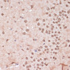Immunohistochemistry of paraffin-embedded Mouse brain using ITCH Polyclonal Antibody at dilution of  1:100 (40x lens).