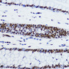 Immunohistochemistry of paraffin-embedded Human colon using Acetyl-Histone H2B-K12 Polyclonal Antibody at dilution of  1:200 (40x lens).