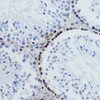 Immunohistochemistry of paraffin-embedded Mouse testis using Acetyl-Histone H2B-K12 Polyclonal Antibody at dilution of  1:200 (40x lens).