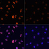 Immunofluorescence analysis of C6 cells using Acetyl-Histone H2B-K12 Polyclonal Antibody at dilution of  1:100.C6 cells were treated by TSA (1 uM) at 37℃ for 18 hours. Blue: DAPI for nuclear staining.