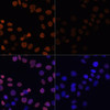 Immunofluorescence analysis of HeLa cells using Acetyl-Histone H2B-K12 Polyclonal Antibody at dilution of  1:100.HeLa cells were treated by TSA (1 uM) at 37℃ for 18 hours. Blue: DAPI for nuclear staining.