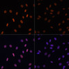 Immunofluorescence analysis of NIH/3T3 cells using Acetyl-Histone H2B-K12 Polyclonal Antibody at dilution of  1:100.NIH/3T3 cells were treated by TSA (1 uM) at 37℃ for 18 hours. Blue: DAPI for nuclear staining.