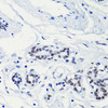 Immunohistochemistry of paraffin-embedded Human breast using Acetyl-Histone H2A-K5 Polyclonal Antibody at dilution of  1:100 (40x lens).