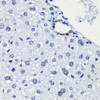 Immunohistochemistry of paraffin-embedded Mouse liver using Acetyl-Histone H2A-K5 Polyclonal Antibody at dilution of  1:100 (40x lens).