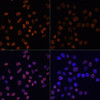 Immunofluorescence analysis of HeLa cells using Acetyl-Histone H2A-K5 Polyclonal Antibody at dilution of  1:100.HeLa cells were treated by TSA (1 uM) at 37℃ for 18 hours. Blue: DAPI for nuclear staining.