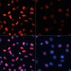 Immunofluorescence analysis of C6 cells using Acetyl-Histone H2B-K5 Polyclonal Antibody at dilution of  1:100.C6 cells were treated by TSA (1 uM) at 37℃ for 18 hours. Blue: DAPI for nuclear staining.