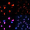 Immunofluorescence analysis of HeLa cells using Acetyl-Histone H2B-K5 Polyclonal Antibody at dilution of  1:100.HeLa cells were treated by TSA (1 uM) at 37℃ for 18 hours. Blue: DAPI for nuclear staining.