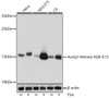 Western blot analysis of extracts of various cell lines using Acetyl-Histone H2B-K15 Polyclonal Antibody at dilution of 1:1000. HeLa cells were treated by TSA (1 uM) at 37°C for 18 hours. NIH/3T3 cells were treated by TSA (1 uM) at 37°C for 18 hours. C6 cells were treated by TSA (1 uM) at 37°C for 18 hours.