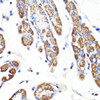 Immunohistochemistry of paraffin-embedded Human stomach using RNF149 Polyclonal Antibody at dilution of  1:100 (40x lens).