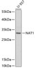 Western blot analysis of extracts of U-937 cells using NAT1 Polyclonal Antibody at dilution of 1:1000.