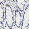 Immunohistochemistry of paraffin-embedded Human colon using p27 KIP 1 Polyclonal Antibody at dilution of  1:100 (40x lens).