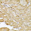 Immunohistochemistry of paraffin-embedded Rat heart using SLC25A5 Polyclonal Antibody at dilution of  1:100 (40x lens).