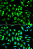 Immunofluorescence analysis of MCF-7 cells using CHRM2 Polyclonal Antibody