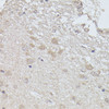 Immunohistochemistry of paraffin-embedded Rat brain using PPP2R5D Polyclonal Antibody at dilution of  1:100 (40x lens).