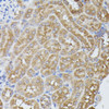 Immunohistochemistry of paraffin-embedded Mouse kidney using PPP2R5D Polyclonal Antibody at dilution of  1:100 (40x lens).