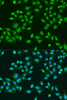 Immunofluorescence analysis of U2OS cells using RPS6KB1 Polyclonal Antibody at dilution of  1:100. Blue: DAPI for nuclear staining.