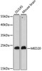 Western blot analysis of extracts of various cell lines using MED20 Polyclonal Antibody at dilution of 1:1000.