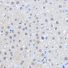 Immunohistochemistry of paraffin-embedded Rat liver using RBM39 Polyclonal Antibody at dilution of  1:100 (40x lens).