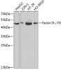 Western blot analysis of extracts of various cell lines using Factor IX / F9 Polyclonal Antibody at dilution of 1:1000.