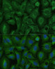 Immunofluorescence analysis of U-2 OS cells using TIMM8B Polyclonal Antibody at dilution of  1:100 (40x lens). Blue: DAPI for nuclear staining.