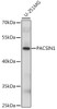 Western blot analysis of extracts of U-251MG cells using PACSIN1 Polyclonal Antibody at dilution of 1:1000.