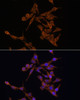 Immunofluorescence analysis of HeLa cells using UBE2J1 Polyclonal Antibody at dilution of  1:100. Blue: DAPI for nuclear staining.