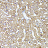 Immunohistochemistry of paraffin-embedded Rat liver using CDK5RAP1 Polyclonal Antibody at dilution of  1:100 (40x lens).