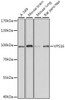 Western blot analysis of extracts of various cell lines using VPS16 Polyclonal Antibody at dilution of 1:1000.