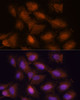 Immunofluorescence analysis of C6 cells using UPF3A Polyclonal Antibody at dilution of  1:100. Blue: DAPI for nuclear staining.