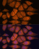 Immunofluorescence analysis of HeLa cells using UPF3A Polyclonal Antibody at dilution of  1:100. Blue: DAPI for nuclear staining.