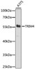 Western blot analysis of extracts of A375 cells using TRIM4 Polyclonal Antibody at dilution of 1:1000.