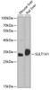 Western blot analysis of extracts of various cell lines using SULT1A1 Polyclonal Antibody at dilution of 1:1000.