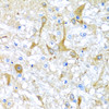 Immunohistochemistry of paraffin-embedded Rat brain using SULT1A1 Polyclonal Antibody at dilution of  1:100 (40x lens).