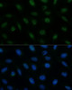 Immunofluorescence analysis of U-2 OS cells using CENPA Polyclonal Antibody at dilution of  1:100 (40x lens). Blue: DAPI for nuclear staining.