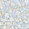 Immunohistochemistry of paraffin-embedded Mouse stomach using GPX2 Polyclonal Antibody at dilution of  1:100 (40x lens).