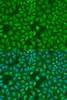 Immunofluorescence analysis of U2OS cells using MonoMethyl-UHRF1-K385 Polyclonal Antibody at dilution of  1:100. Blue: DAPI for nuclear staining.