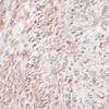 Immunohistochemistry of paraffin-embedded Human uterus using LAMC1 Polyclonal Antibody at dilution of  1:100 (40x lens).