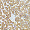 Immunohistochemistry of paraffin-embedded Rat liver using MAP3K1 Polyclonal Antibody at dilution of  1:100 (40x lens).
