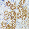 Immunohistochemistry of paraffin-embedded Mouse kidney using MAP3K1 Polyclonal Antibody at dilution of  1:100 (40x lens).