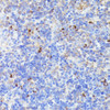 Immunohistochemistry of paraffin-embedded Rat lymph node using CCDC6 Polyclonal Antibody at dilution of  1:100 (40x lens).