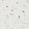 Immunohistochemistry of paraffin-embedded Rat brain using CCDC6 Polyclonal Antibody at dilution of  1:100 (40x lens).