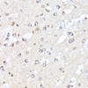 Immunohistochemistry of paraffin-embedded Mouse brain using CCDC6 Polyclonal Antibody at dilution of  1:100 (40x lens).