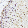 Immunohistochemistry of paraffin-embedded Human esophageal using MLF2 Polyclonal Antibody at dilution of  1:100 (40x lens).