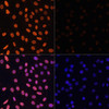 Immunofluorescence analysis of C6 cells using Acetyl-Histone H3-K36 Polyclonal Antibody at dilution of  1:100.C6 cells were treated by TSA (1 uM) at 37℃ for 18 hours. Blue: DAPI for nuclear staining.