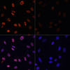 Immunofluorescence analysis of NIH/3T3 cells using Acetyl-Histone H3-K36 Polyclonal Antibody at dilution of  1:100.NIH/3T3 cells were treated by TSA (1 uM) at 37℃ for 18 hours. Blue: DAPI for nuclear staining.