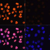 Immunofluorescence analysis of HeLa cells using Acetyl-Histone H3-K4 Polyclonal Antibody at dilution of  1:100.HeLa cells were treated by TSA (1 uM) at 37℃ for 18 hours. Blue: DAPI for nuclear staining.