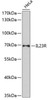 Western blot analysis of extracts of HeLa cells using IL23R Polyclonal Antibody at dilution of 1:1000.