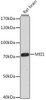 Western blot analysis of extracts of Rat brain using MEI1 Polyclonal Antibody at dilution of 1:1000.