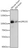 Western blot analysis of extracts of various cell lines using GPR155 Polyclonal Antibody at dilution of 1:1000.