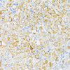 Immunohistochemistry of paraffin-embedded Rat ovary using USP33 Polyclonal Antibody at dilution of  1:100 (40x lens).